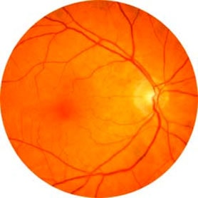 Eye-Exam-Opticians-in-Hackney